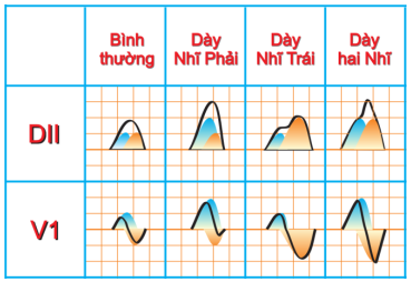 A graph of different types of graphs

Description automatically generated with medium confidence