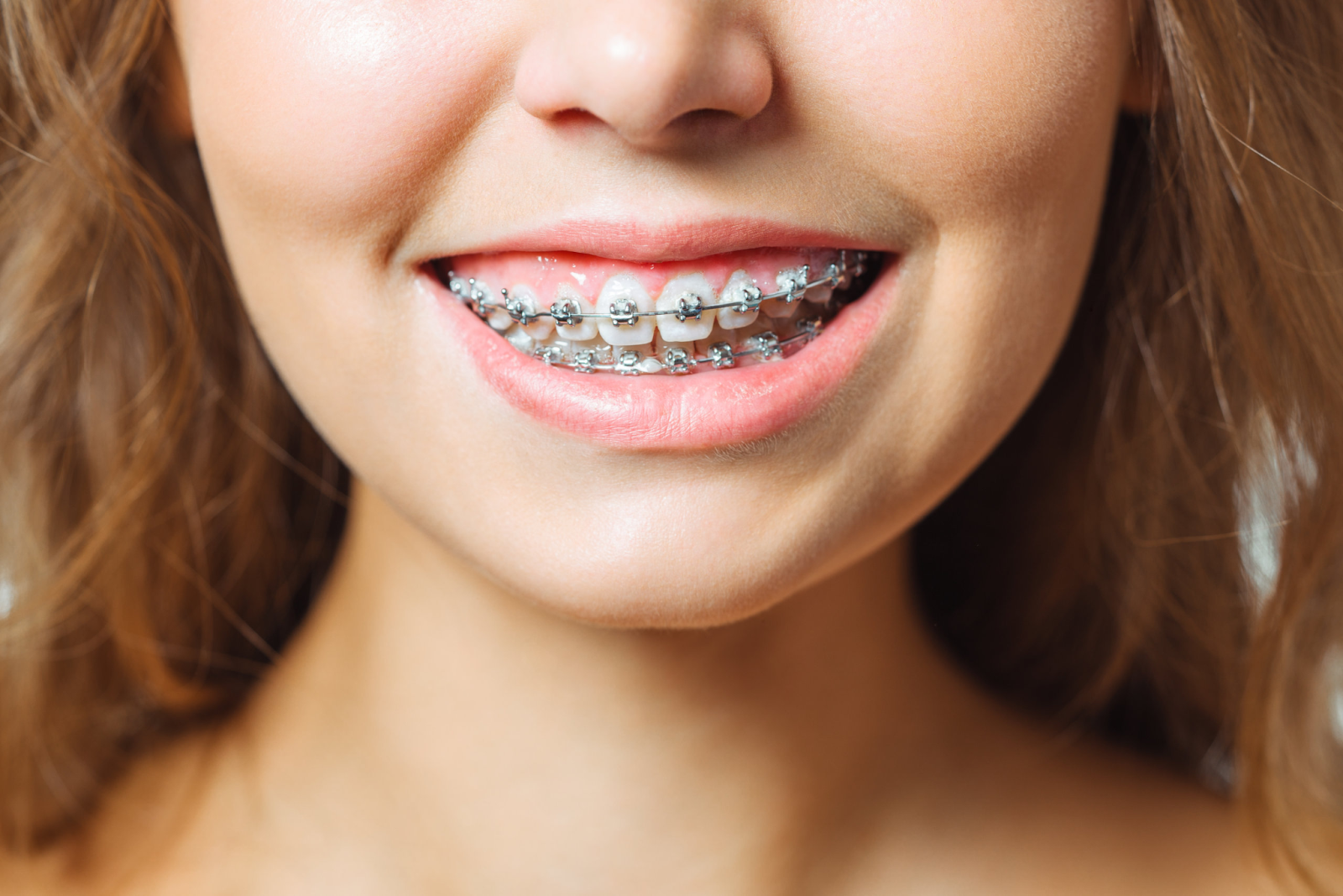 Orthodontic Treatment