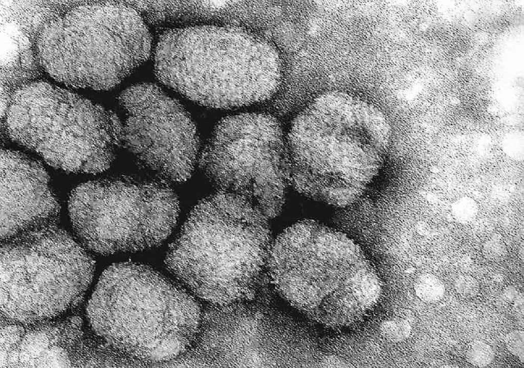 أسباب مرض الجدري هو فيروس الجدري (Variola virus)، وينتقل من شخص لآخر بطرق متعددة. الطريقة الرئيسية لانتقال الفيروس هي عبر الهواء، حيث يمكن أن ينتقل عن طريق قطرات صغيرة تطلق عند السعال أو العطس من شخص مصاب. كما يمكن أن ينتقل المرض عبر الاتصال المباشر مع البثور أو سوائل الجسم للشخص المصاب. بالإضافة إلى ذلك، قد يسهم الاتصال الوثيق والازدحام في تسريع انتشار الفيروس. بعد إصابة الفرد، يظهر المرض بشكل عام من خلال طفح جلدي مميز يتطور إلى بثور مليئة بالصديد. بفضل برامج التطعيم العالمية، تم القضاء على الجدري بشكل فعال، لكن فهم طرق انتقاله وأسبابه يظل مهماً للوقاية من الأمراض المعدية الأخرى.