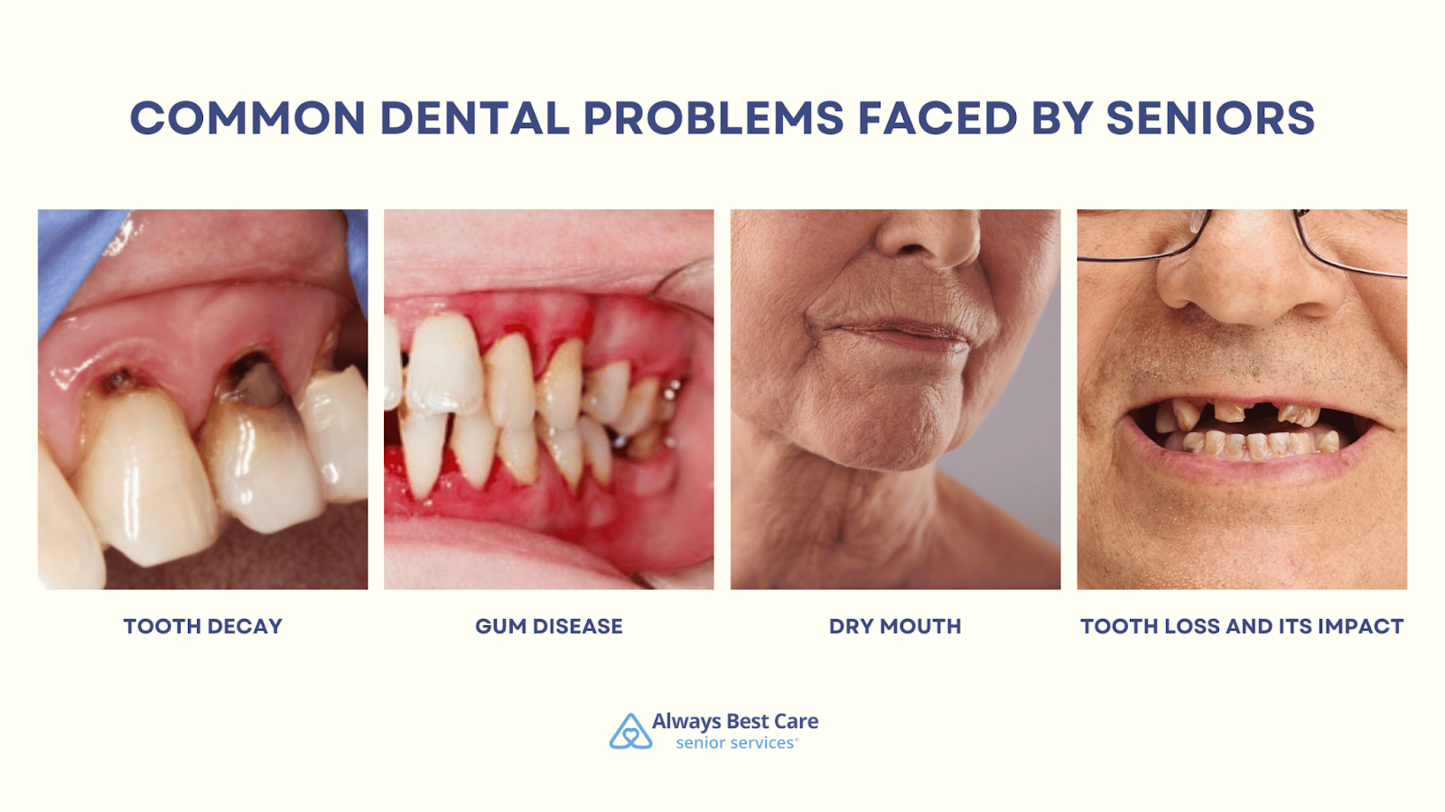 This is an infographic detailing the common dental problems faced by seniors