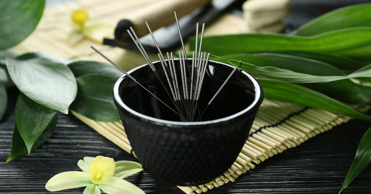 acupuncture points