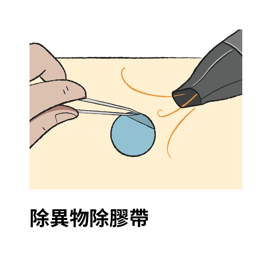 除異物、除膠帶： 使用竹起子和橡膠擦清理書籍表面異物和殘膠。必要時，可用加熱式抹刀或溶劑輕柔移除膠帶和殘膠，避免損壞紙張。