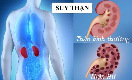 bệnh suy thận trông như thế nào