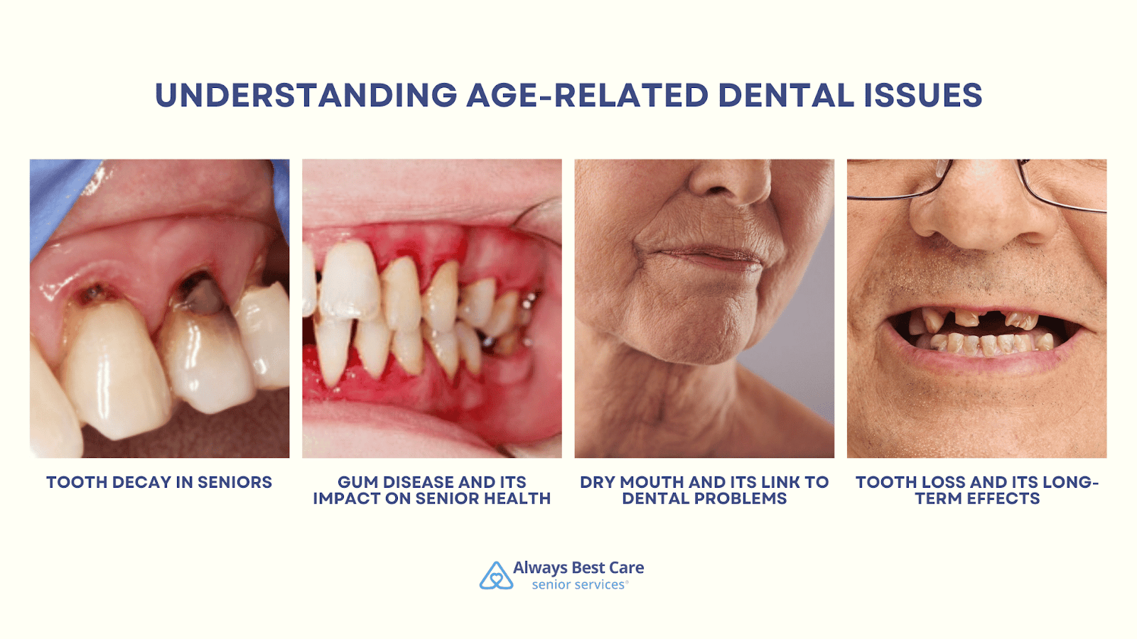 This infographic depicts dental issues faced by seniors