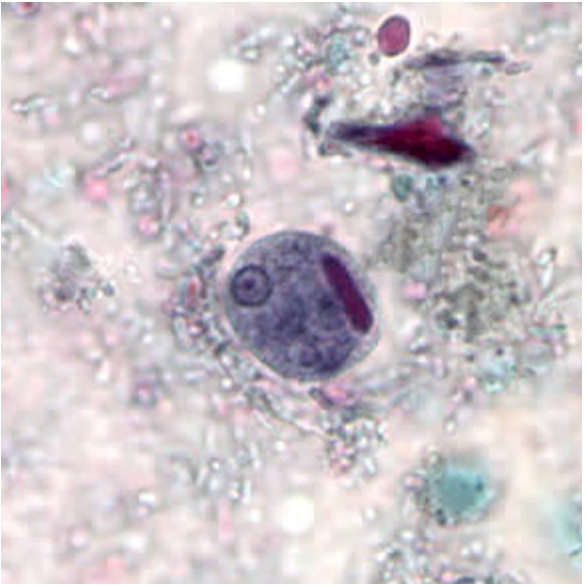 Entamoeba Histolytica cyst