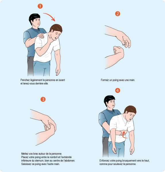C:\Users\se7en\Desktop\lot7-compressions_abdominales.gif