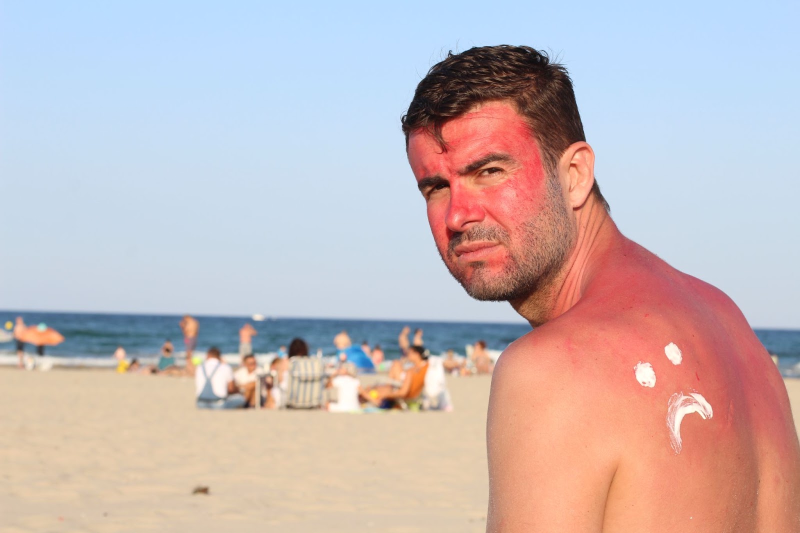 sunburn beach frown