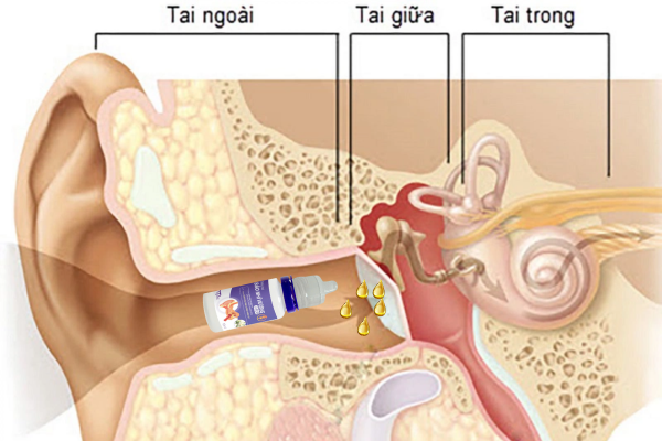 dầu nhỏ tai bảo nhĩ vương drop