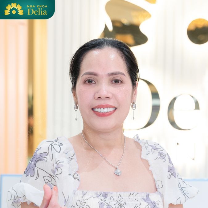 Với miếng dán sứ siêu mỏng này bạn sẽ không cần phải mài răng