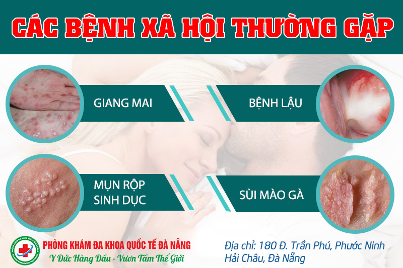 Tác động của bệnh xã hội đến xã hội