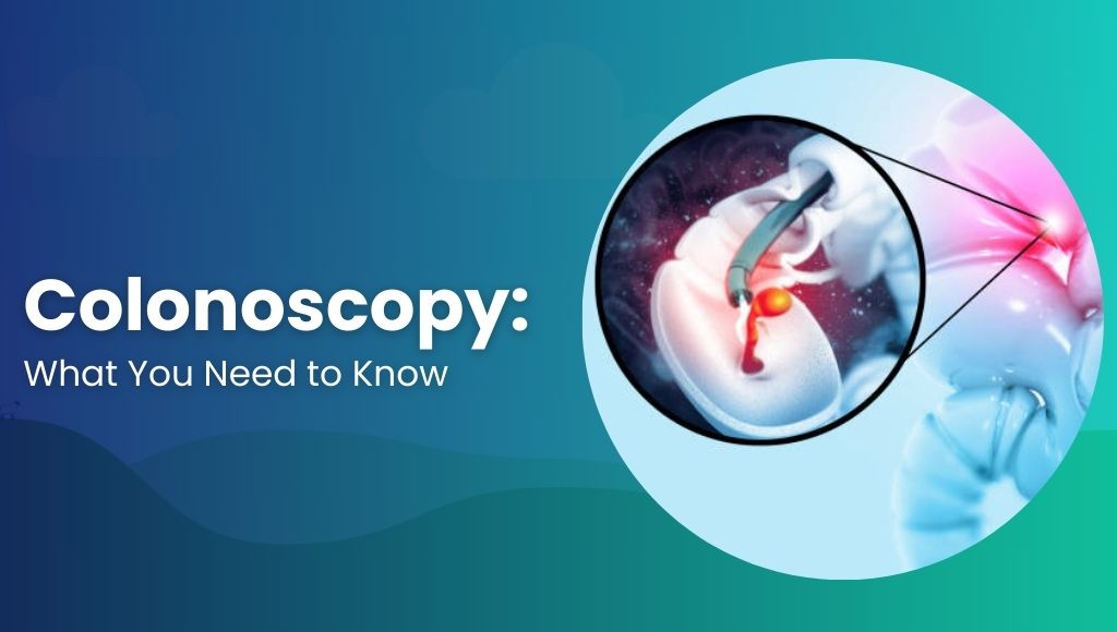 Colonoscopy