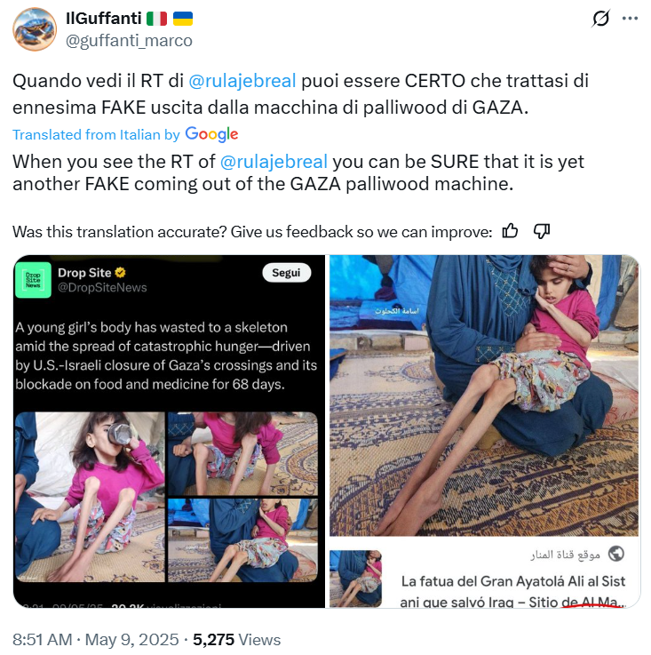 Israeli Trolls Claim Gazans Lied About Malnourished Girl
