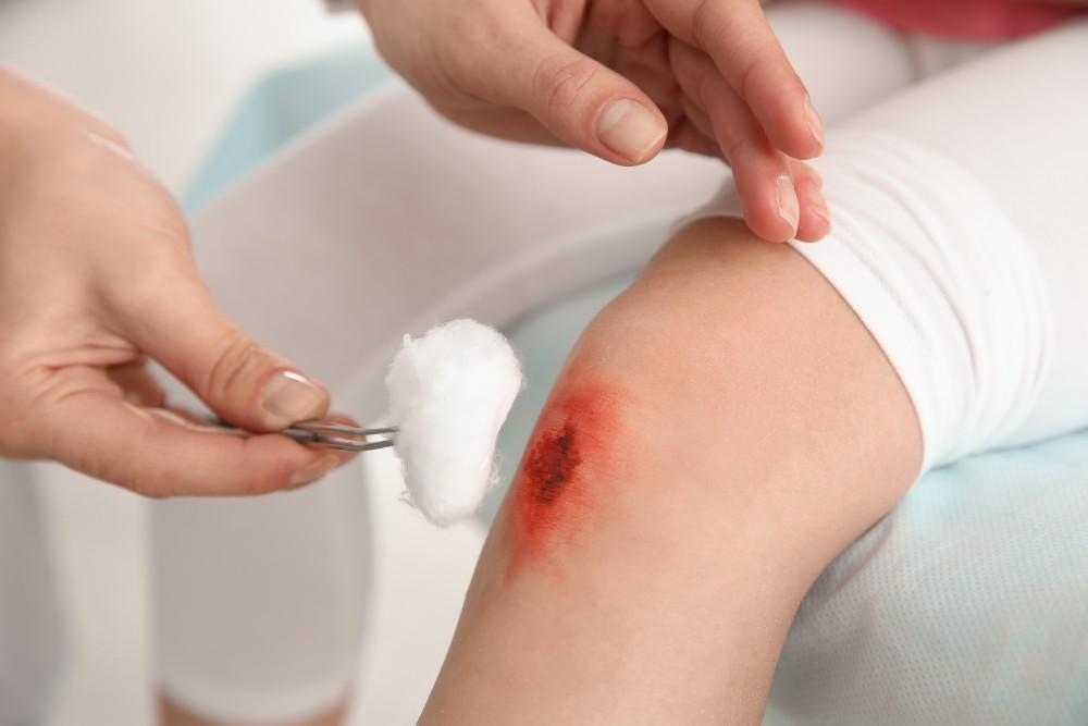 A person cleaning a scraped knee wound with a cotton ball and tweezers.