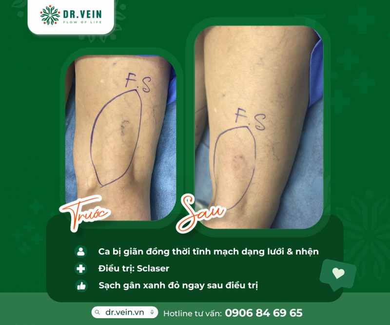 review phong kham drvein 10