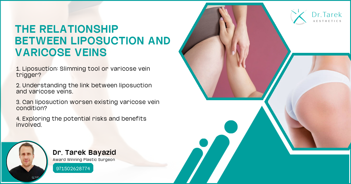 Can Liposuction Cause Varicose Veins