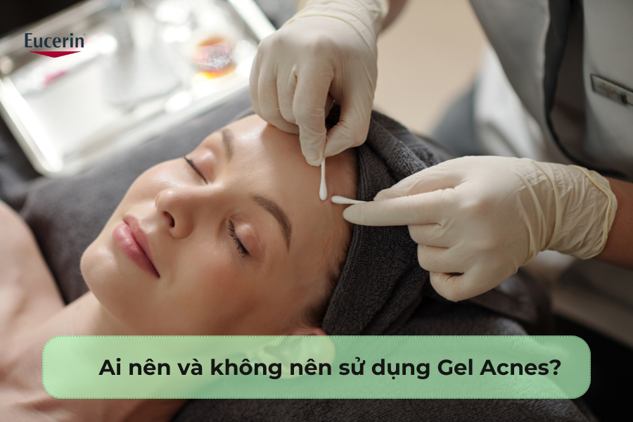 Ai nên và không nên sử dụng Gel Acnes