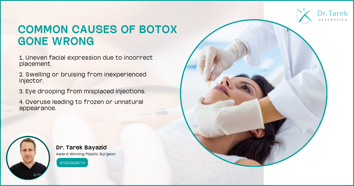 What Happens When Botox Goes Wrong?