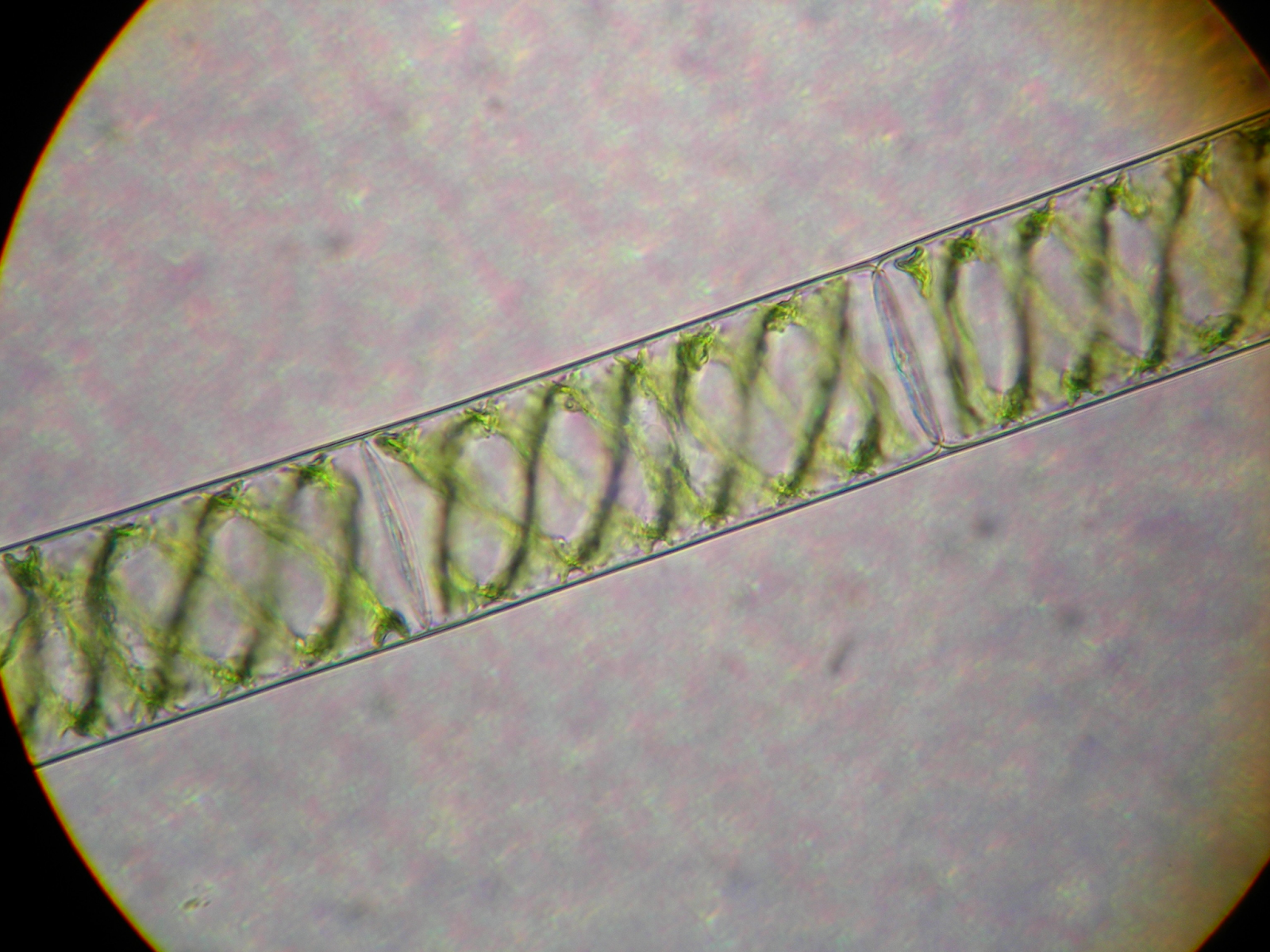 Spirogyra (under the microscope) [Source- Wikipedia]. spirogyra plant. 