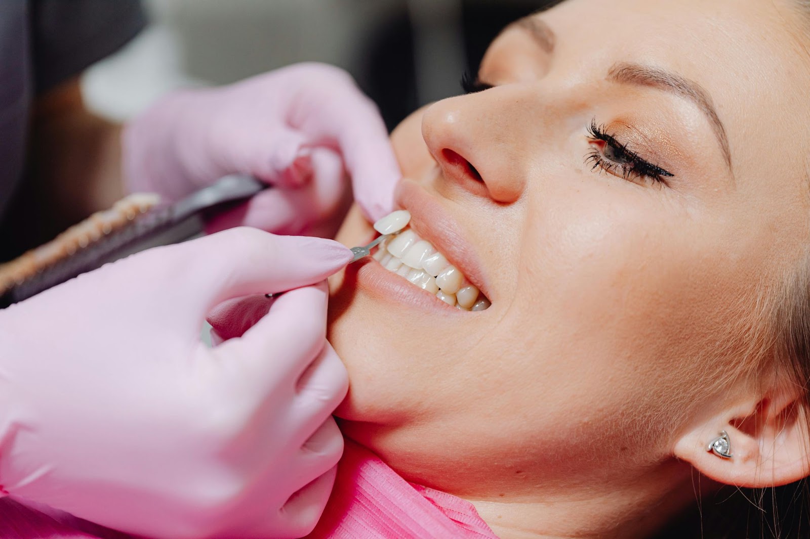 Person getting veneers