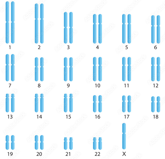 BÀI 6: ĐỘT BIẾN NHIỄM SẮC THỂ