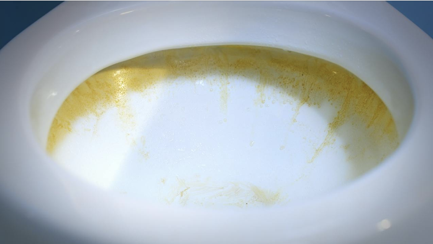 A white toilet bowl with brown stains

Description automatically generated