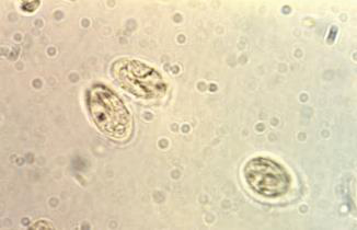 Giardia Lamblia