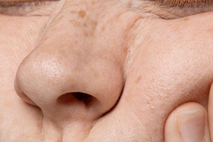 OPEN PORES