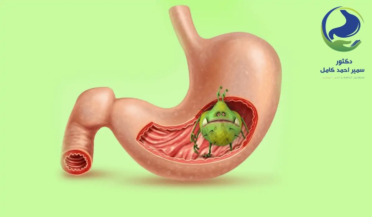 دكتور متخصص في علاج جرثومة المعدة