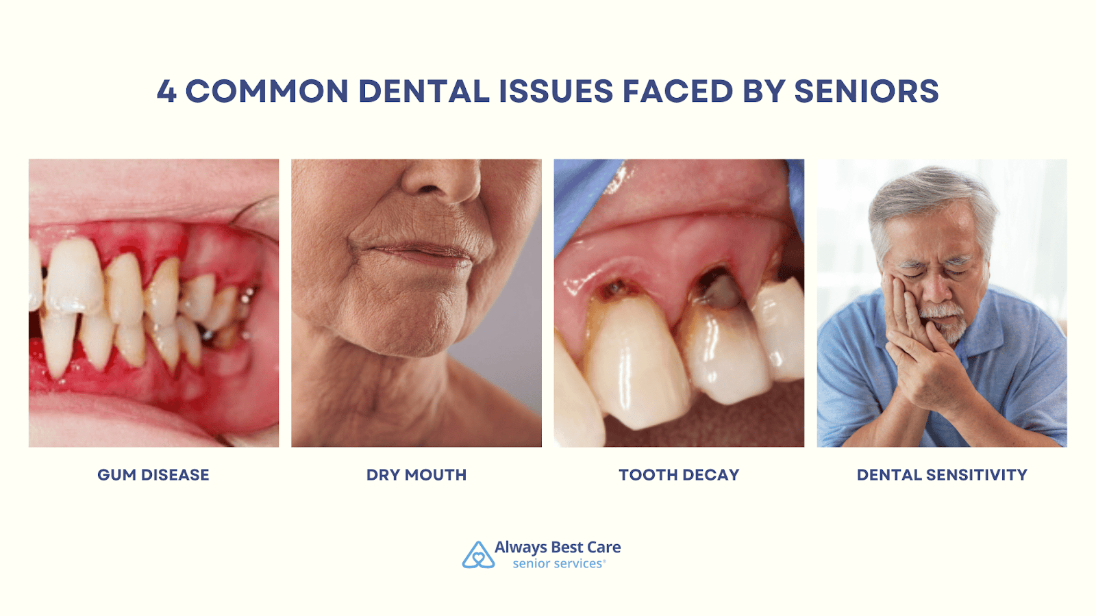 This is an infographic detailing the 4 common dental health issues faced by seniors