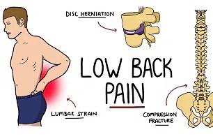 lower back pain