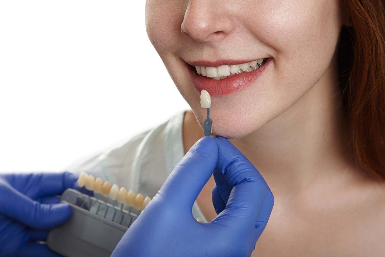 Close-up of a woman smiling during a tooth shade matching procedure with a dental veneer sample held by a gloved hand.

