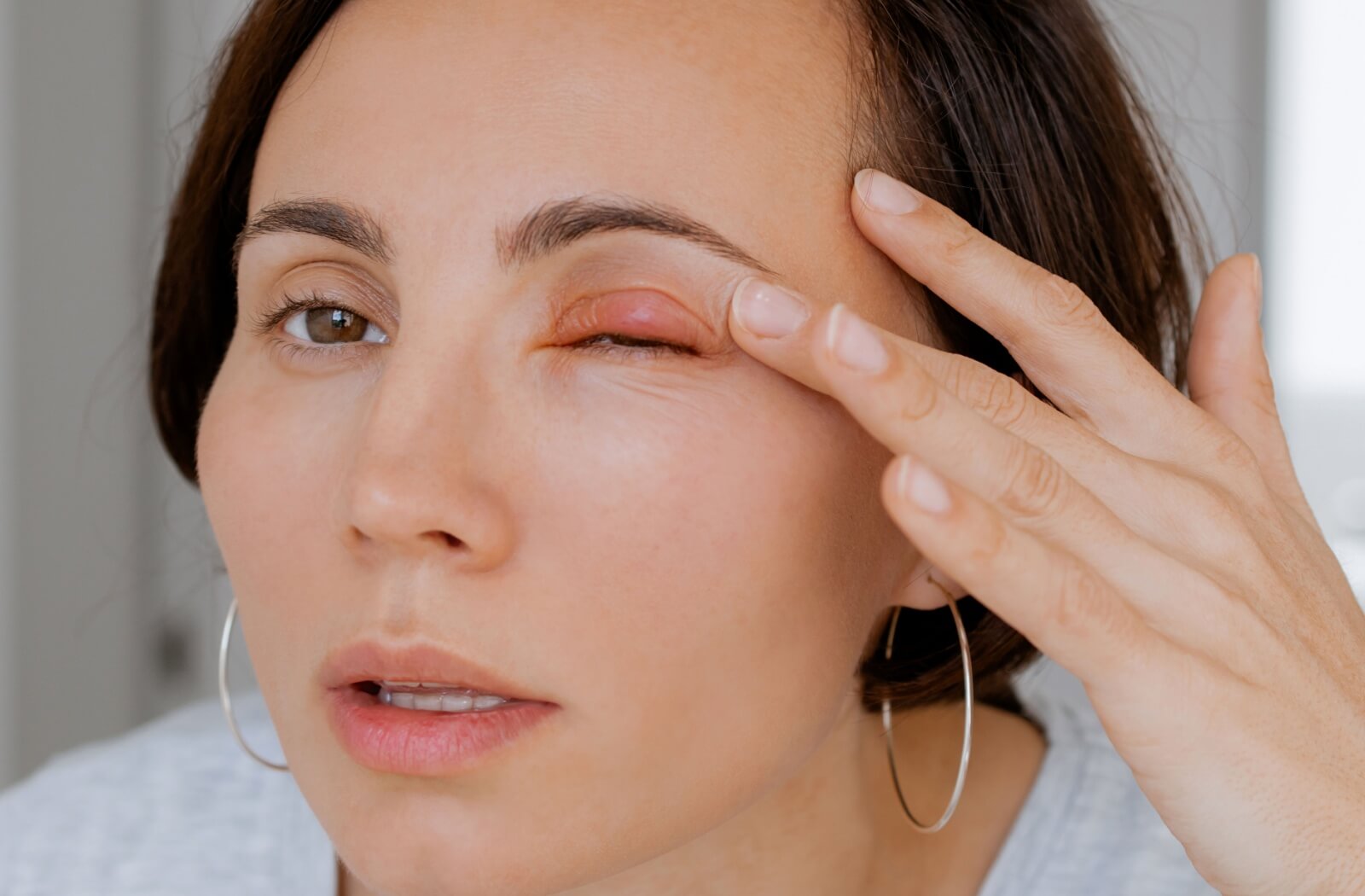 Someone examines a stye on their upper eyelid in a mirror.