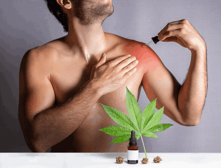 CBD for Pain Treatment: Benefits Beyond the Basics