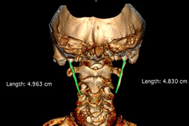 https://verkenlab.com/wp-content/uploads/2020/03/2-aegle.jpg