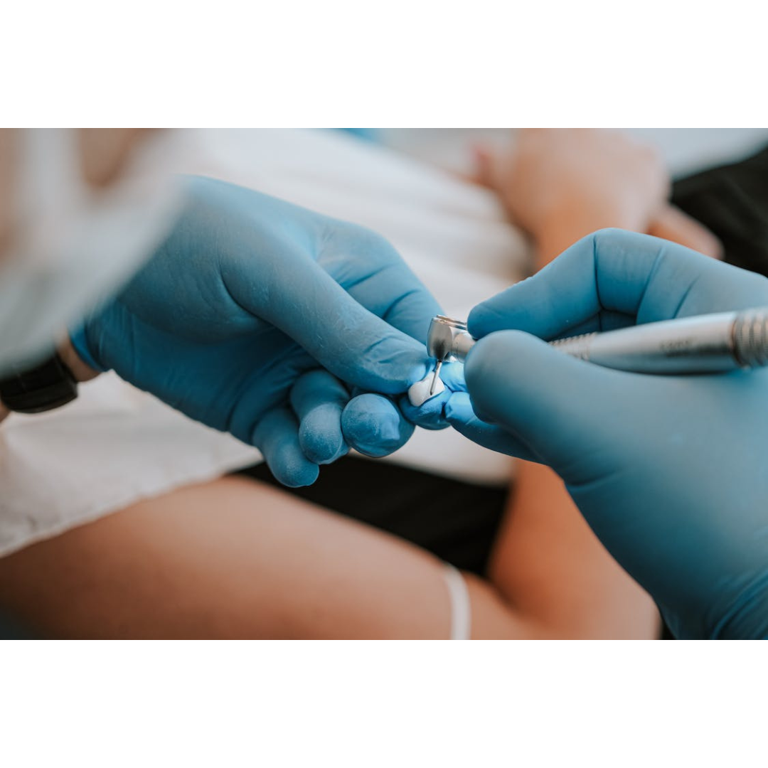 Can a Root Canal Be Done Through a Crown by Skilled Boston Dentists?