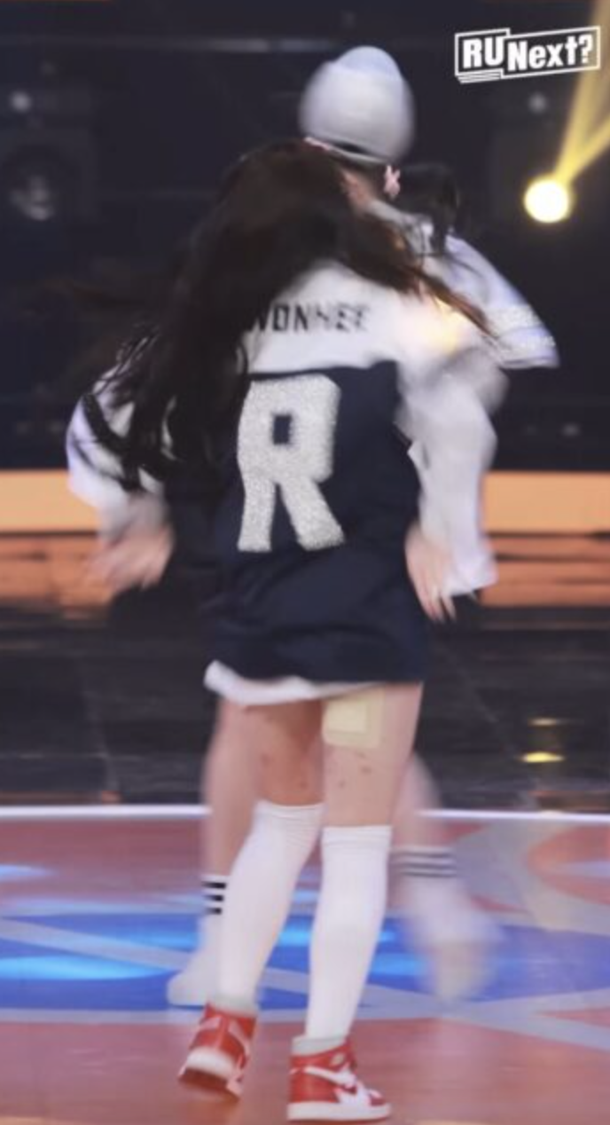 A picture of Wonhee  with noticeable marks on the back of her thighs