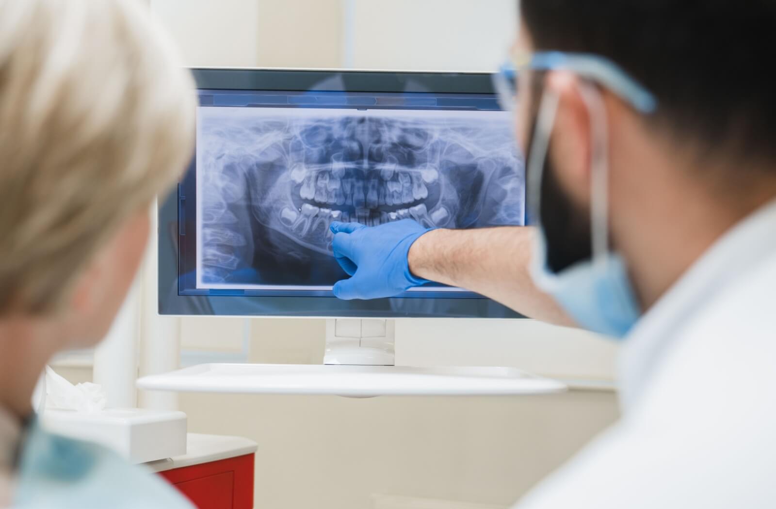 A dentist reviews an X-ray with a patient, pointing to the tooth that needs a root canal