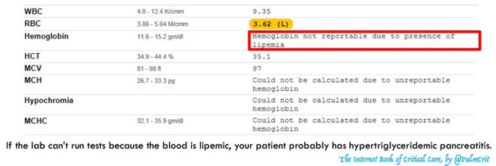 Nếu phòng labo không thể chạy xét nghiệm vì lipid máu cao, bệnh nhân của bạn có khả năng bị viêm tụy cấp tăng triglyceride