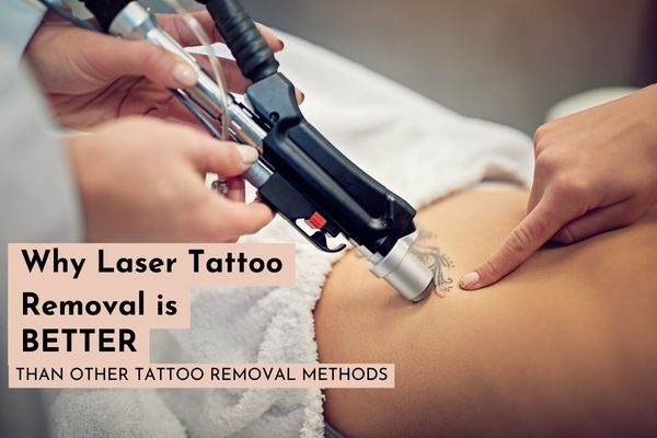 in this image the statement is written why laser tattoo removal is better. 

renewyou.co.in