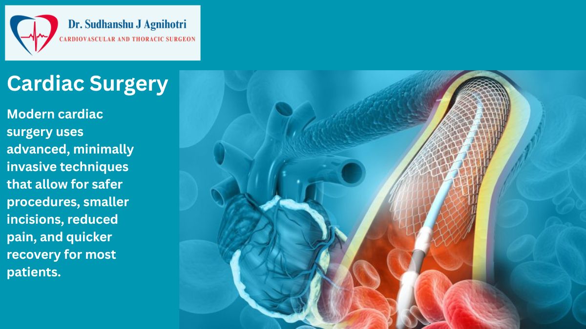 Heart Surgery by Dr Sudhanshu J Agnihotri - Cardiologist in Indore
