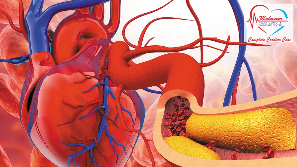 Heart Surgery in Indore by Dr Rakesh Jain - Blood Clotting In Heart