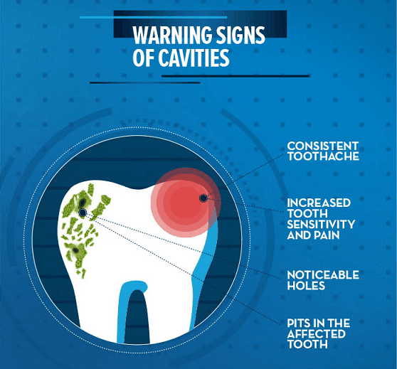 C:\Users\SOLITAIRE\Desktop\symptoms-of-dental-caries.png