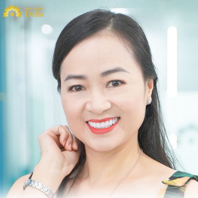 Không phải ai cũng thích hợp dán sứ Veneer siêu mỏng