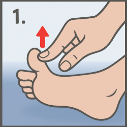 exercices contre aggravation hallux valgus