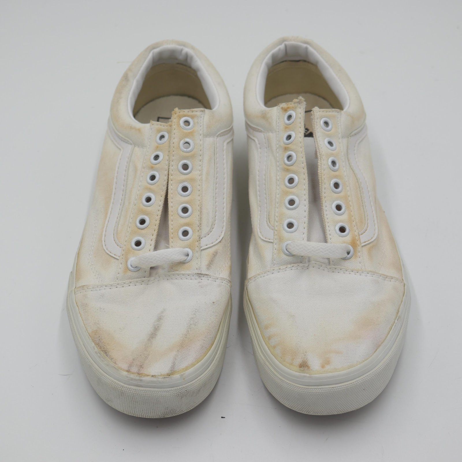 discoloured sneakers