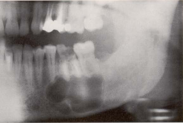 C:\Users\tar\Desktop\stomatologie\IMG_1807.PNG Tumeurs odontogènes et non odontogènes 