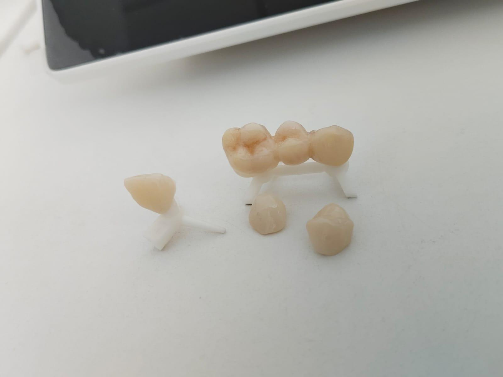 A group of teeth on a white surface Description automatically generated