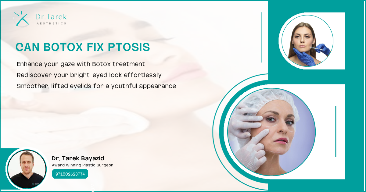 Can Botox Fix Ptosis