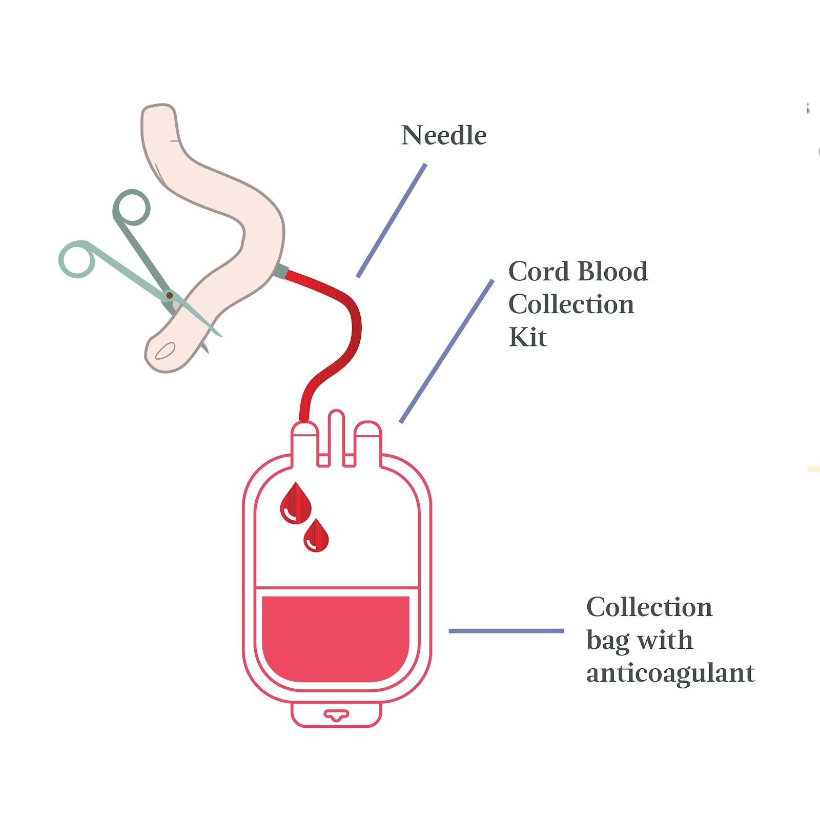 stem cell preservation benefits