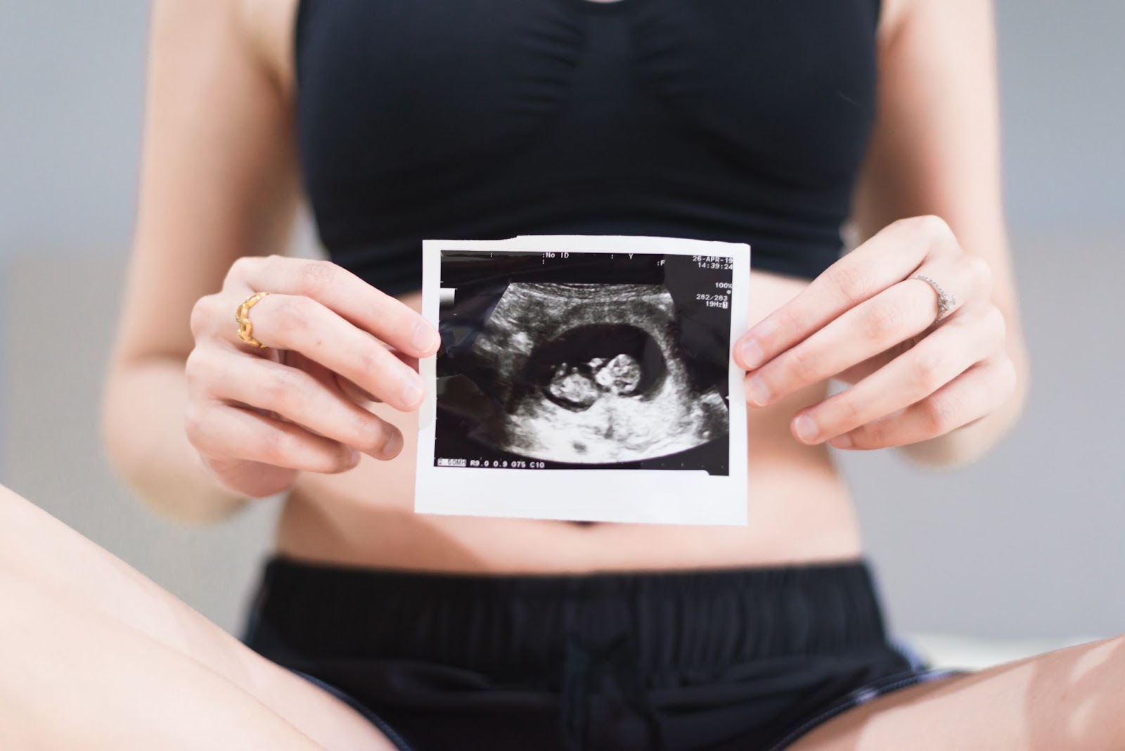 12 týždeň tehotenstva ultrazvuk